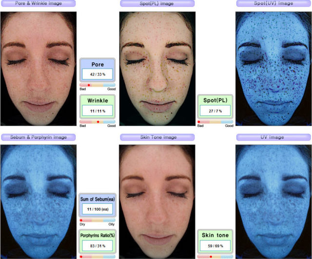 emage skin analysis