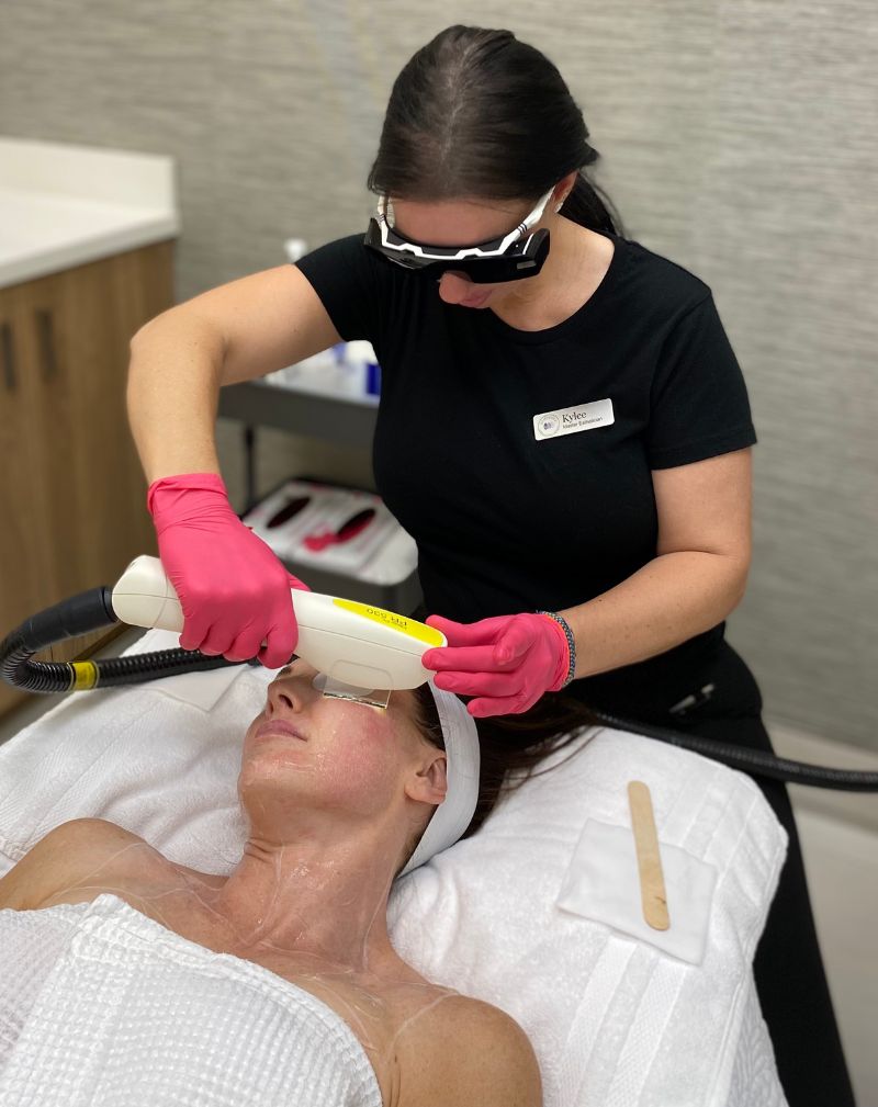 Ipl photofacial utah