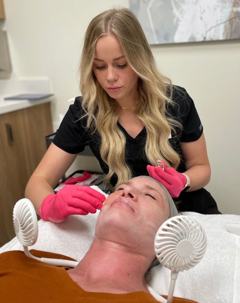 april performing a chemical peel