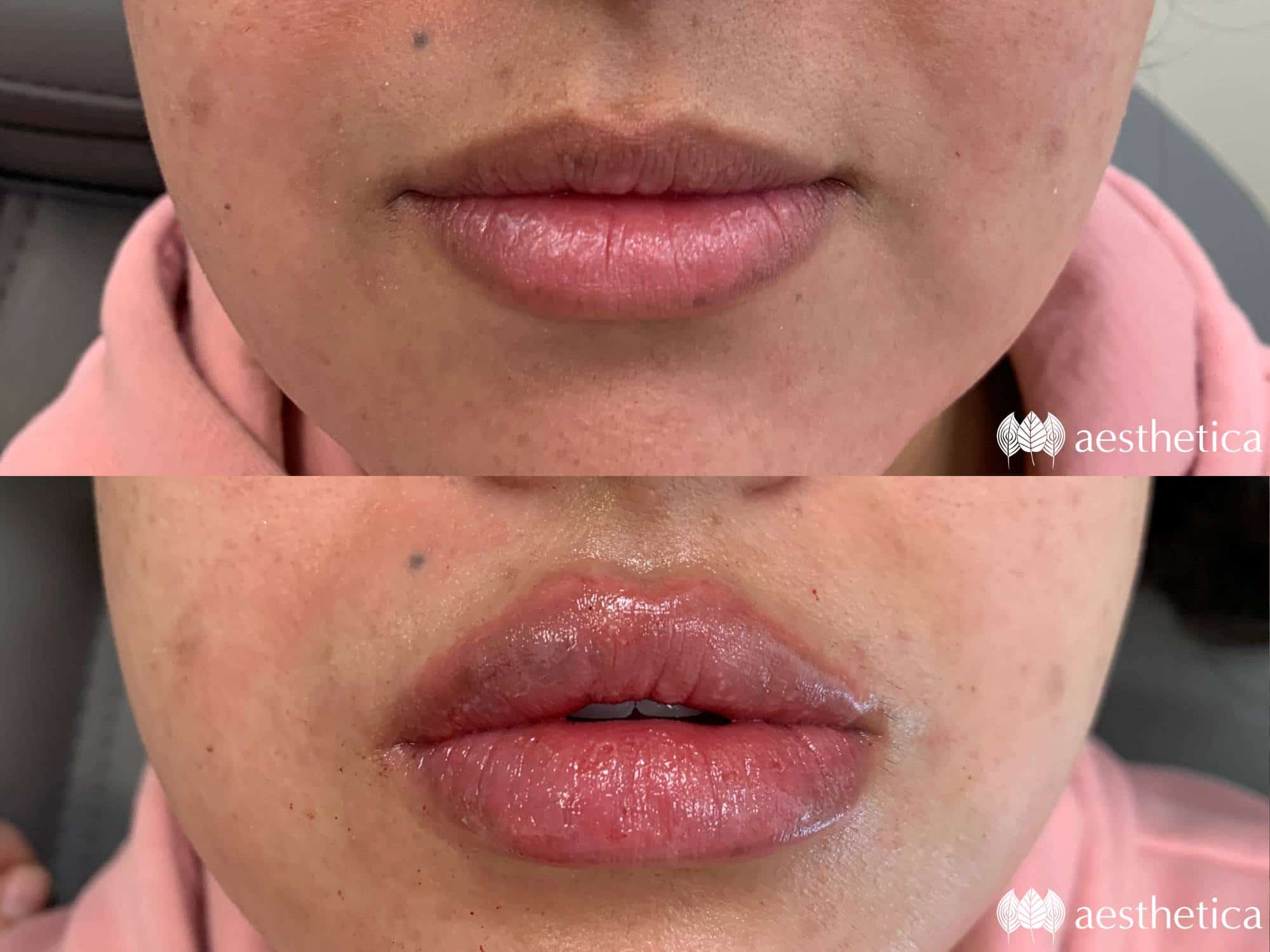 lips-by-rachiele-min