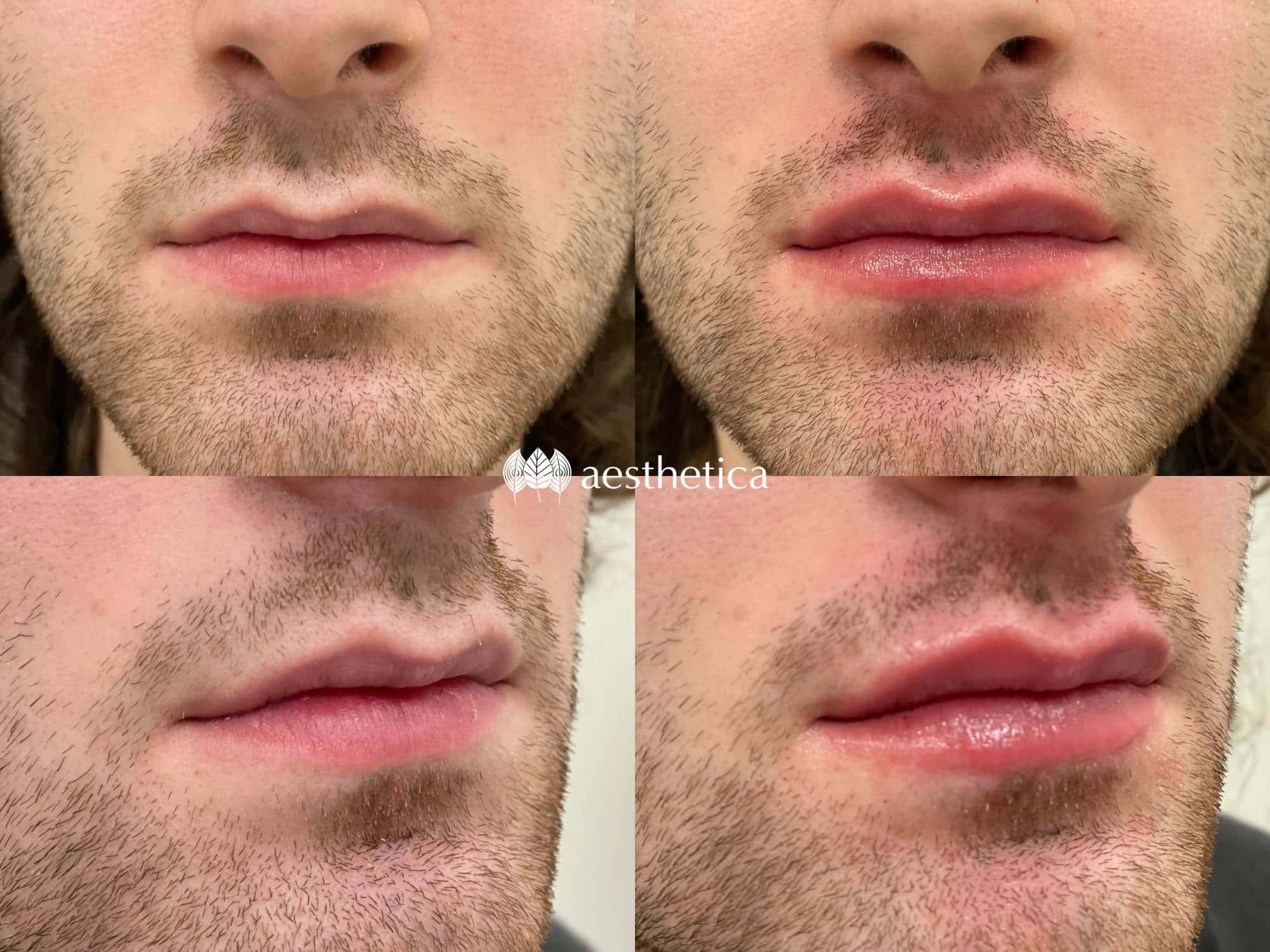 male-lips-by-alyse-min