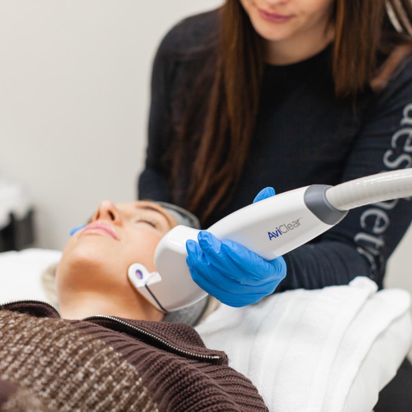 Aviclear acne treatment at Aesthetica in Pleasant Grove