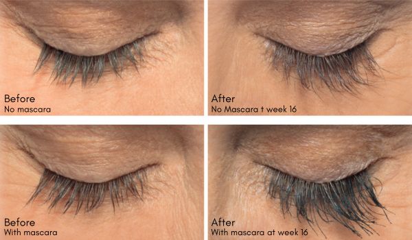 Latisse lash serum