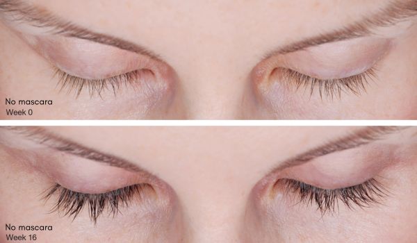 Latisse lash serum