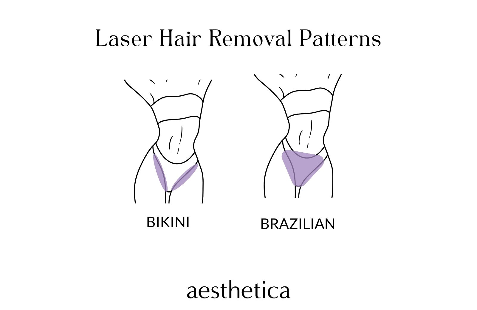 10-things-you-need-to-know-about-brazilian-laser-hair-removal