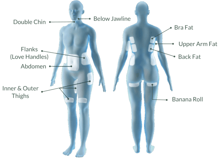 coolsculpting treatment areas