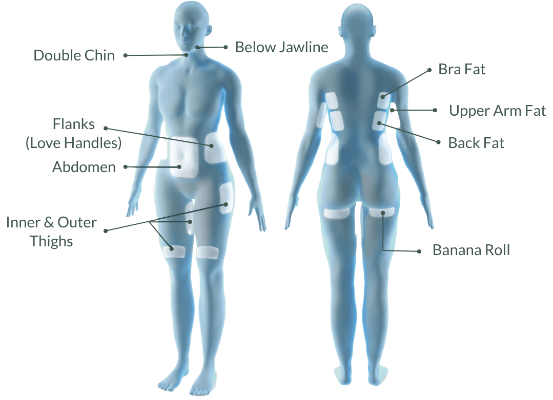 coolsculpting treatment areas