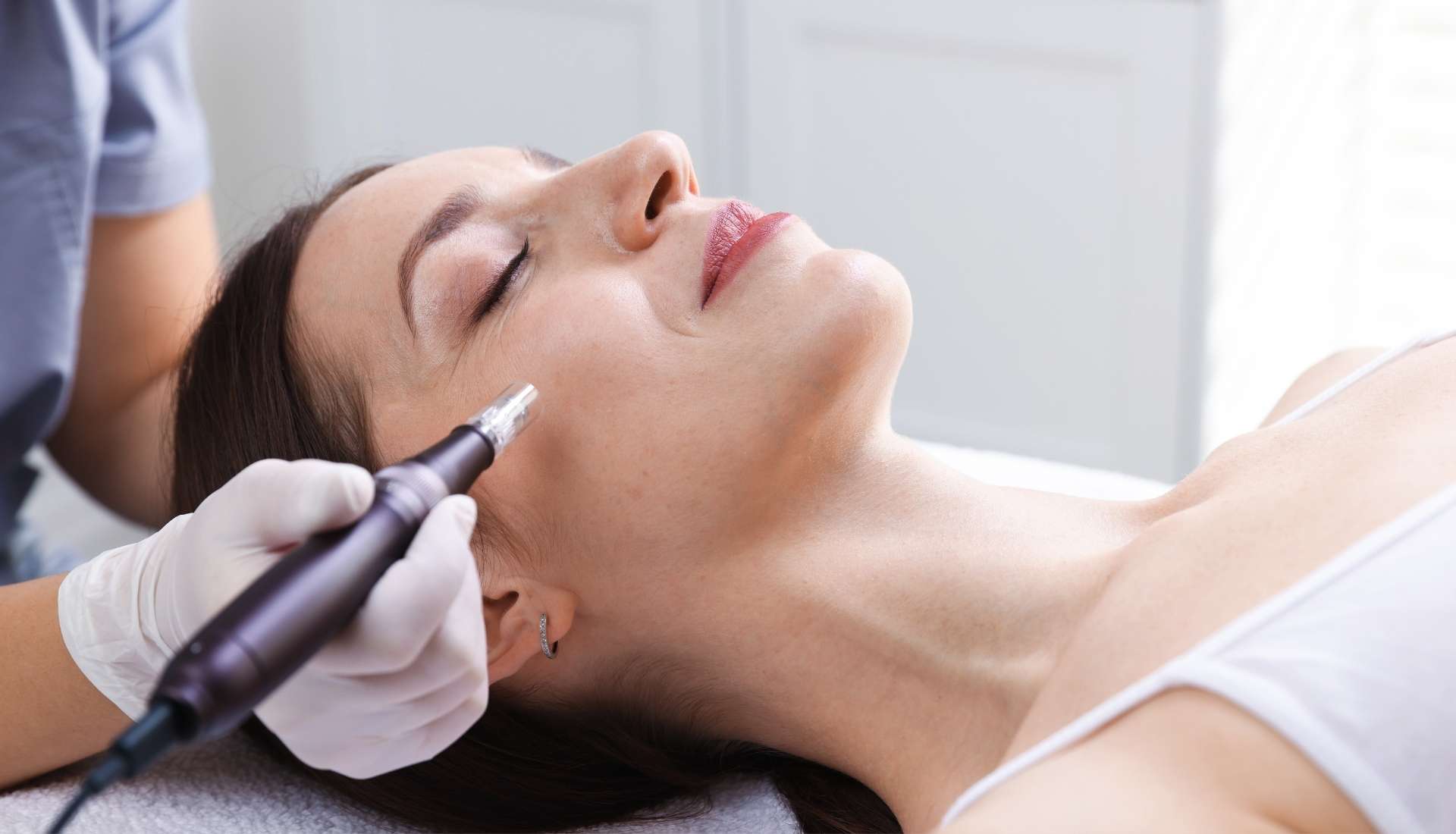 at home vs professional microneedling