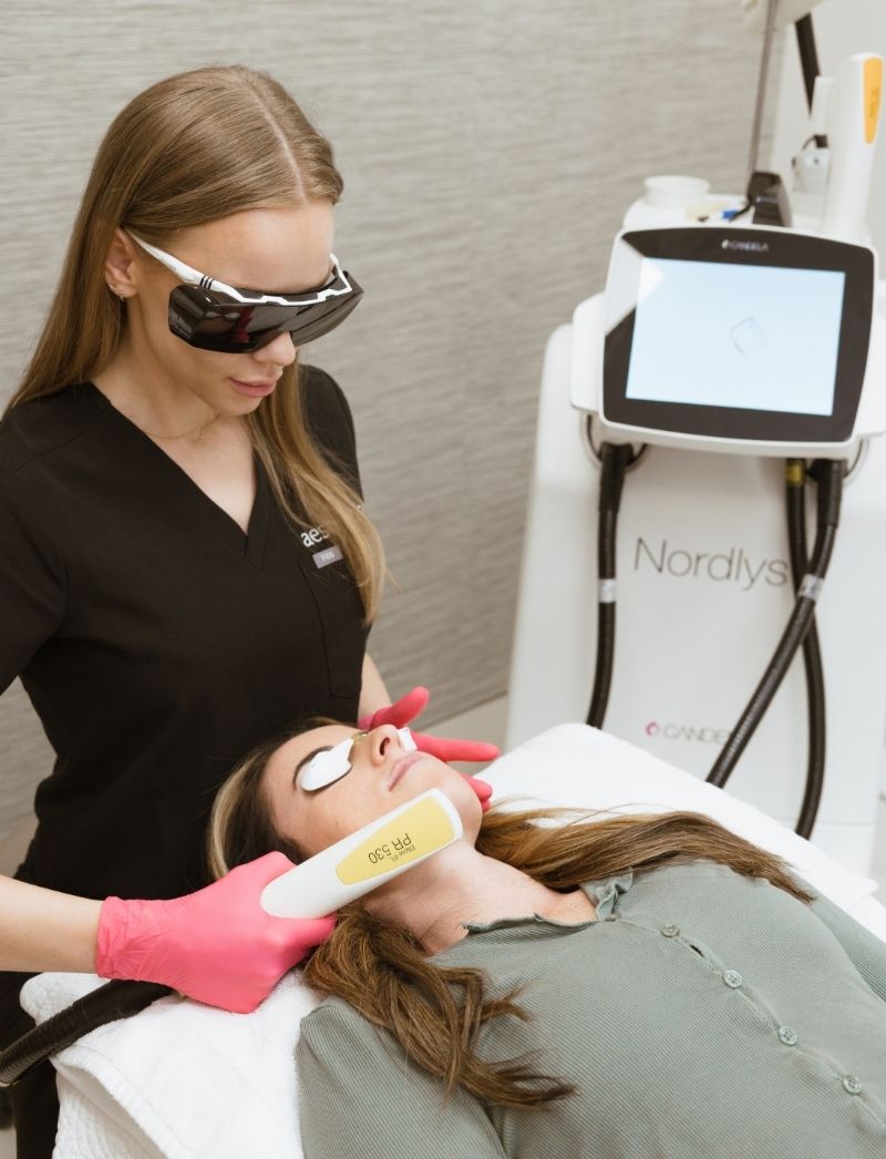 Nordly's ipl photofacial utah