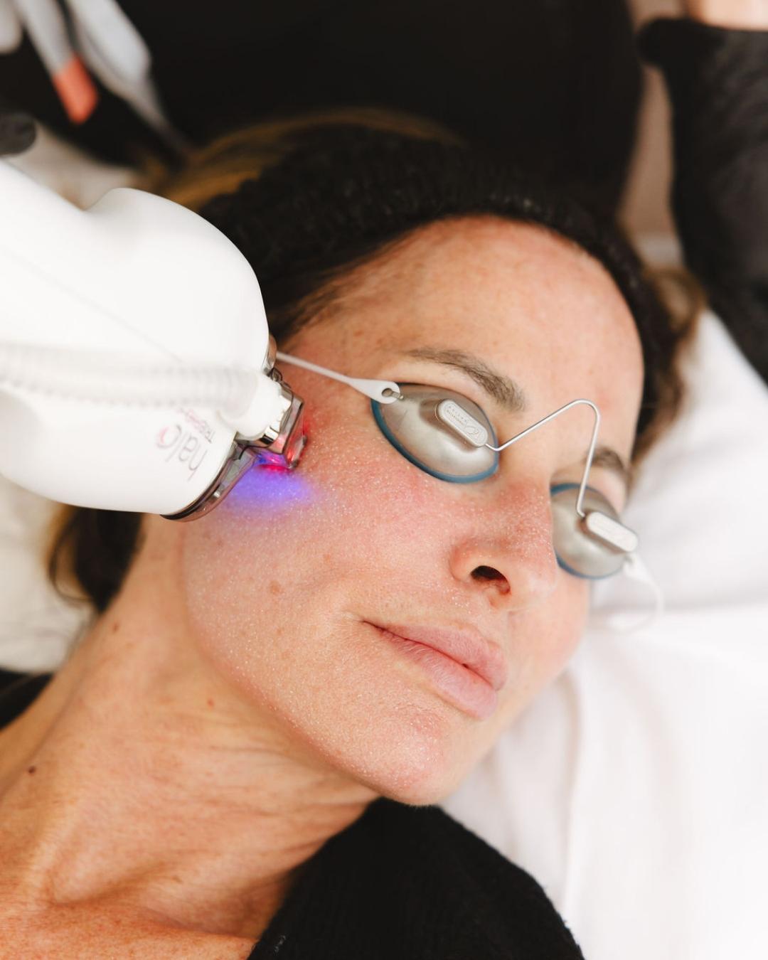 halo tribrid laser in utah