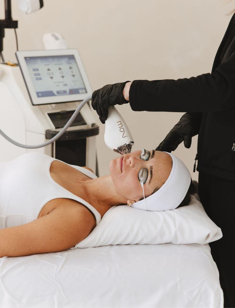 moxi laser treatment near me in utah