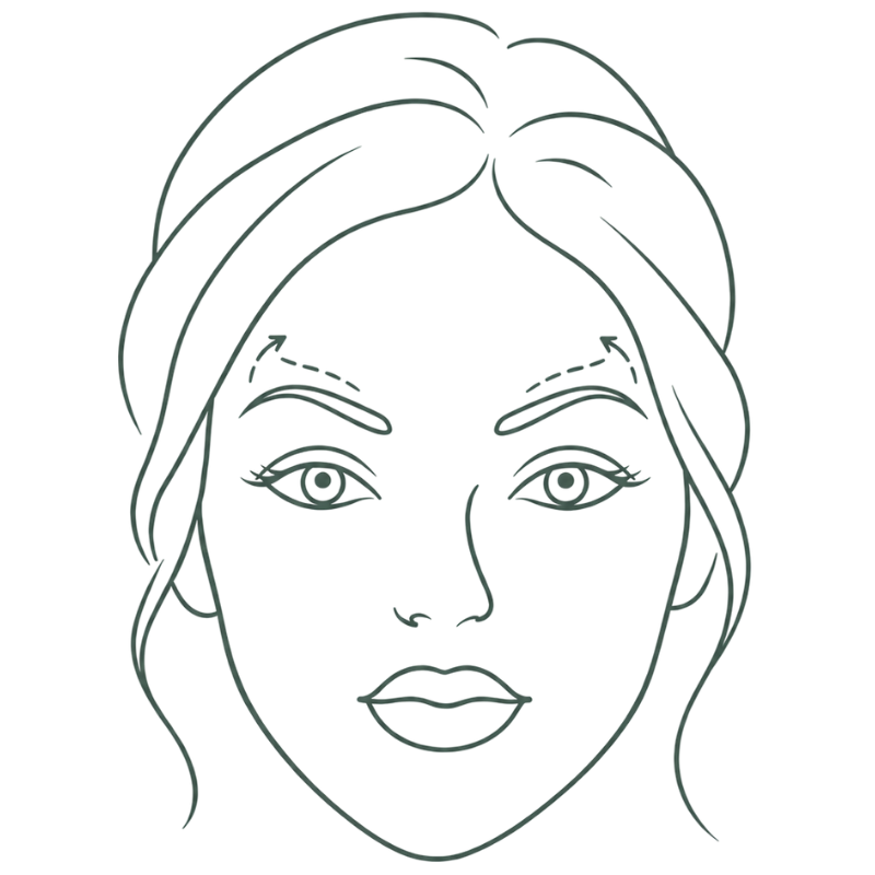 brow lift botox