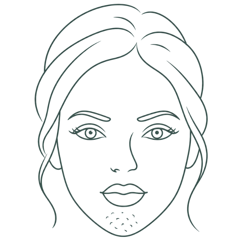 botox for chin dimples