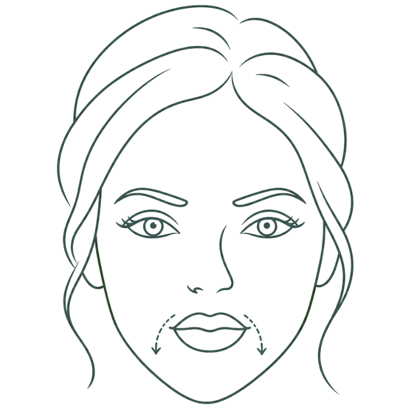 botox for downturned mouth