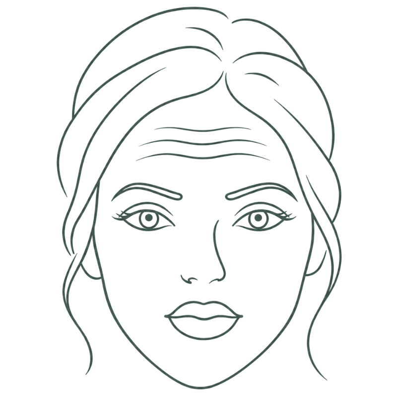 forehead line botox